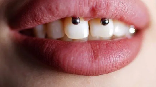 Smiley Piercing Healing Time & Aftercare Guide